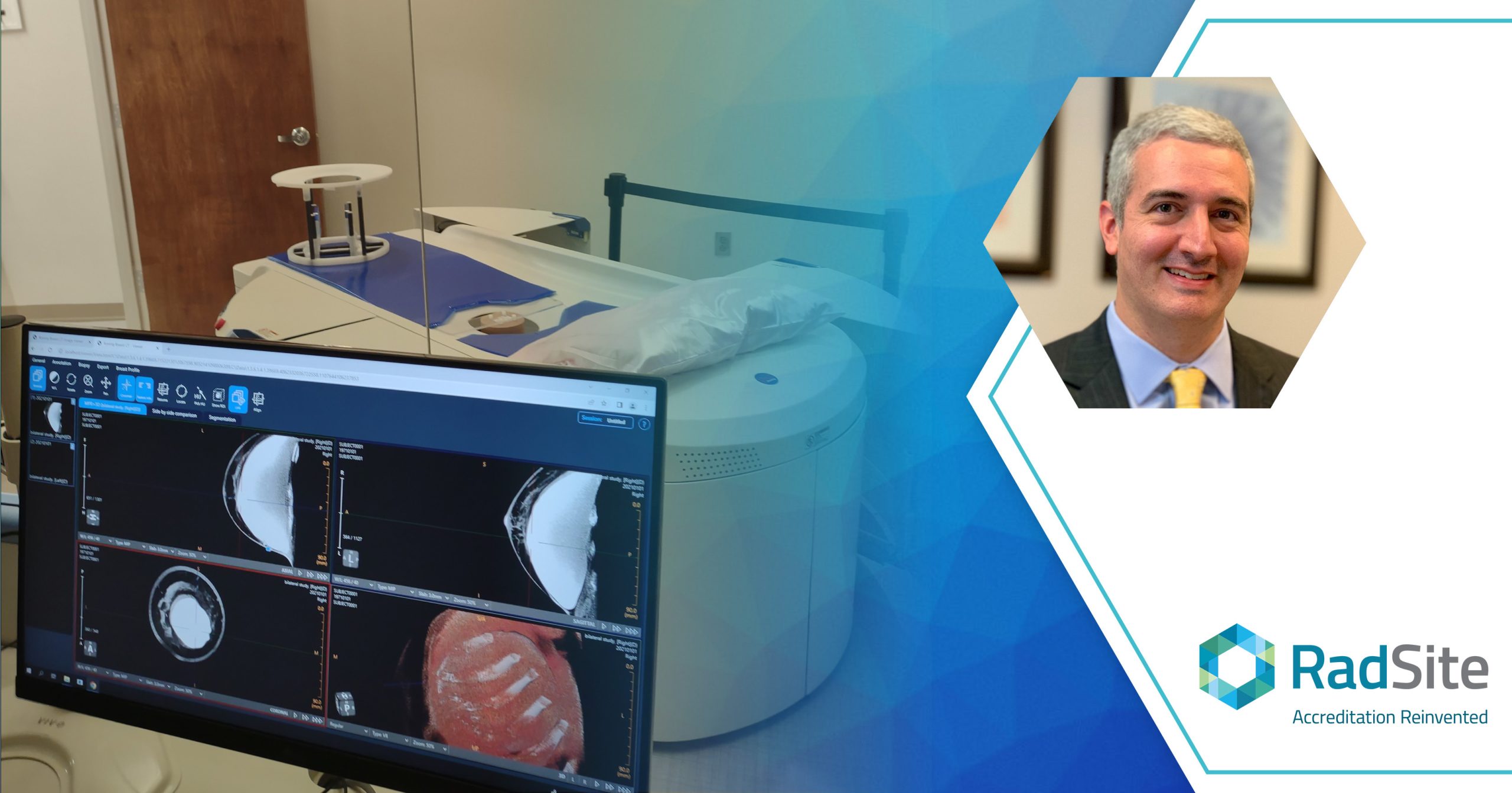 Benefits of Breast Cone Beam CT (CBCT): An Interview with Dr. Richard Reaven